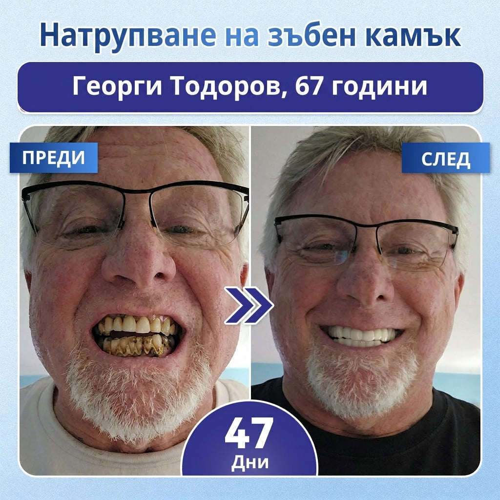 🎁 Остават само 5 опаковки! Предлагаме допълнителна отстъпка от 50%! Влезте във форма и бъдете здрави. Отслабнете сега, иначе няма да имате друга възможност до следващата година!