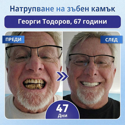 🎁 Остават само 5 опаковки! Предлагаме допълнителна отстъпка от 50%! Влезте във форма и бъдете здрави. Отслабнете сега, иначе няма да имате друга възможност до следващата година!