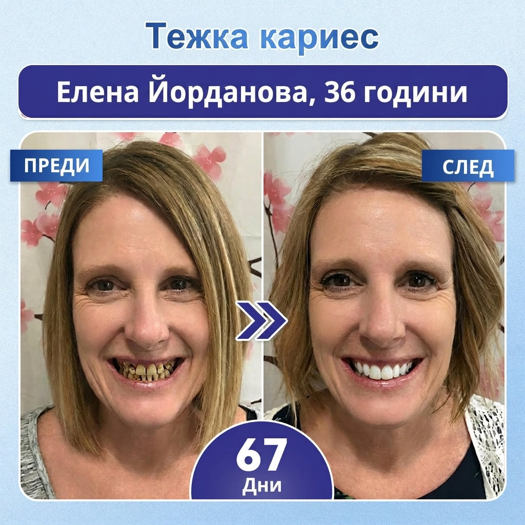 🎁 Остават само 5 опаковки! Предлагаме допълнителна отстъпка от 50%! Влезте във форма и бъдете здрави. Отслабнете сега, иначе няма да имате друга възможност до следващата година!